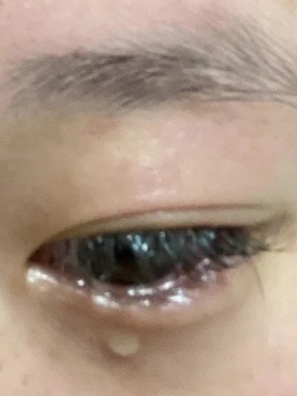crying eyes dp 10