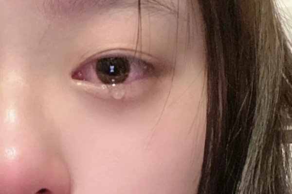 crying eyes dp 13