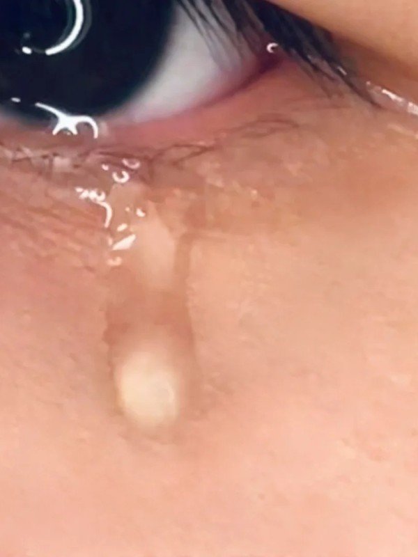 crying eyes dp 7