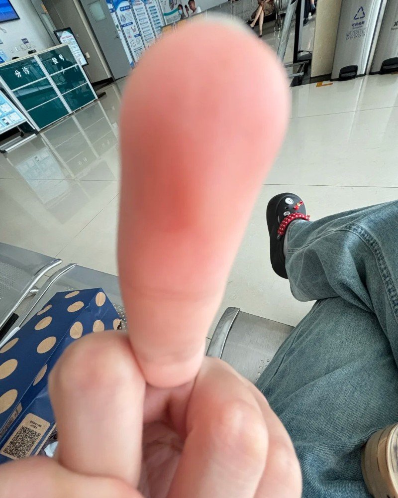 middle finger dp 29