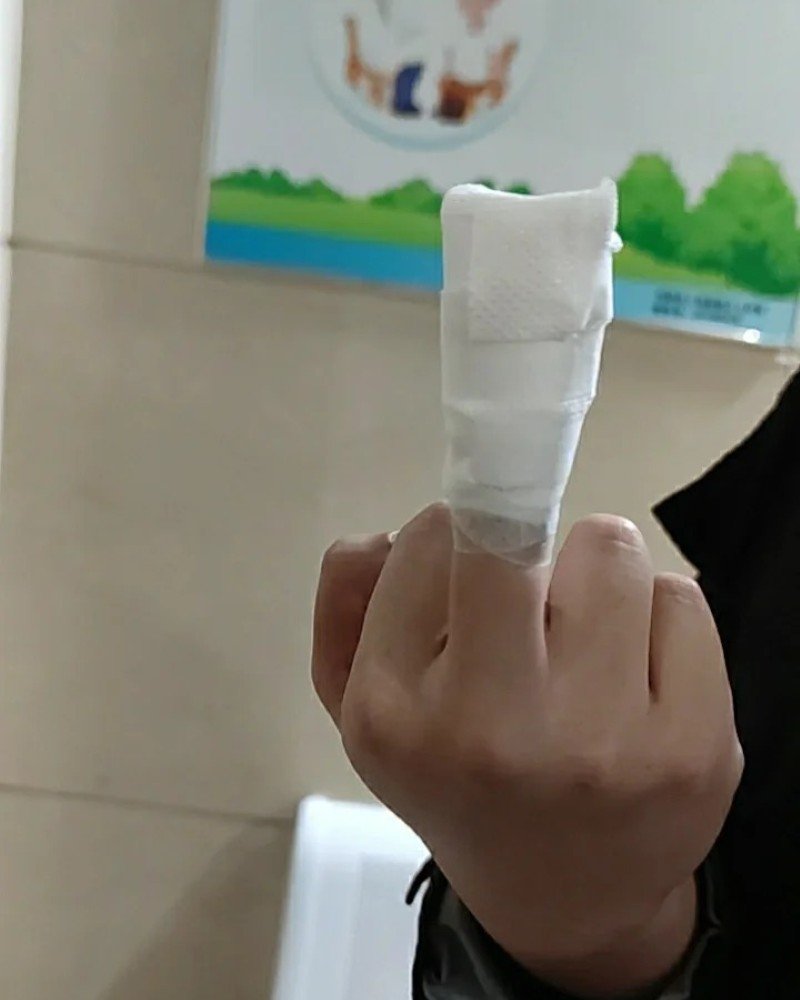 middle finger dp 30